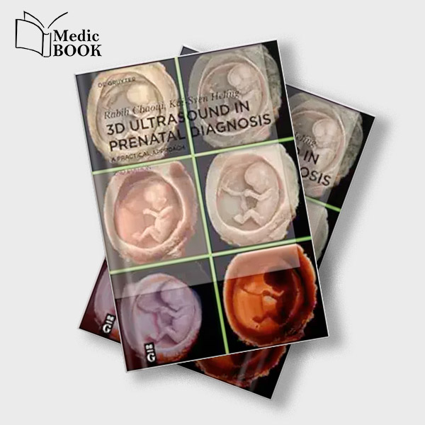 3D Ultrasound In Prenatal Diagnosis A Practical Approach 2nd Edition Original PDF From Publisher