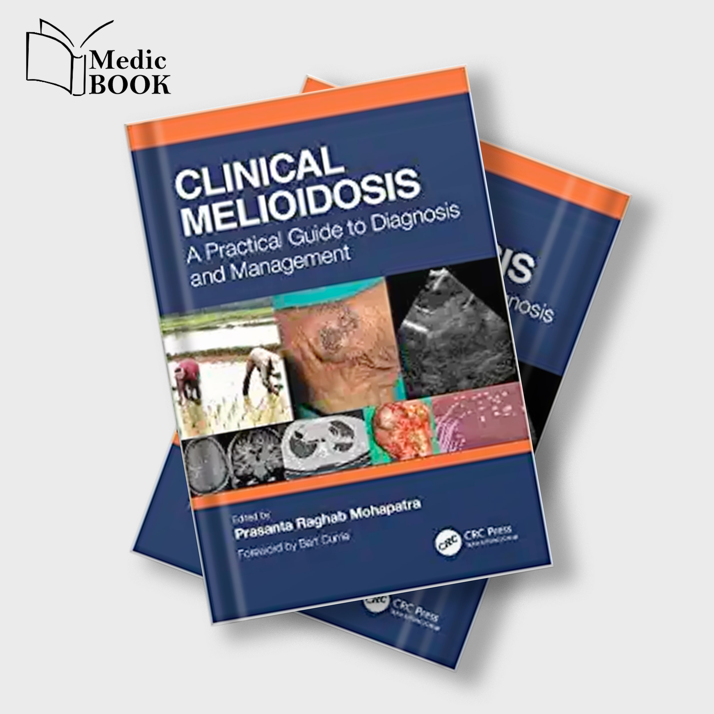 Clinical Melioidosis A Practical Guide to Diagnosis and Management